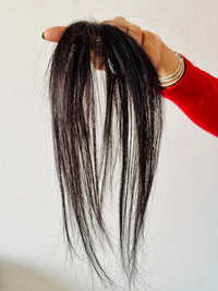 Receding Hairline Frontal